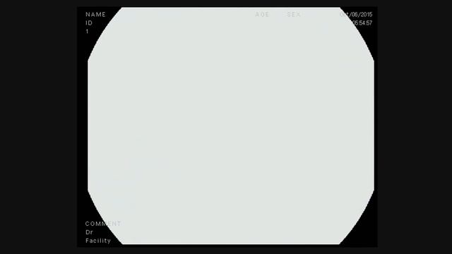 HD endoscopy using Pentax System смотреть онлайн