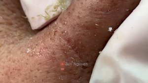 Satisfying and Relaxation with SURI NGUYEN Beauty Spa Video #277