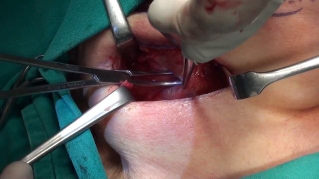 Трансцендентное познание