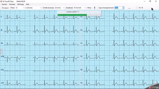 ECG PC EOLYS смотреть онлайн