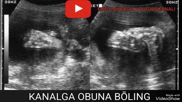 UY SHAROITIDA HOMILA JINSINI 1 SEKUNDDA ANIQLANG. HOMILA JINSINI ANIQLASH USULLARI HAQIDA MA'LUMOT