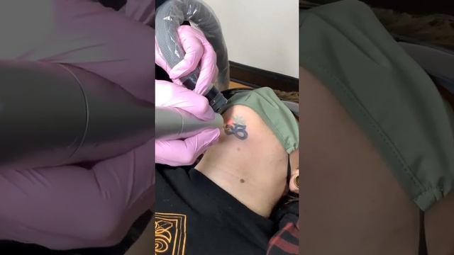 Closer look of neck tattoo removal. смотреть онлайн