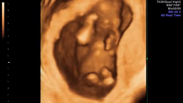 Малыш наш 13 недель смотреть онлайн