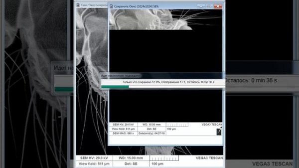 Миры электронной микроскопии: комар-звонец (Chironomidae).