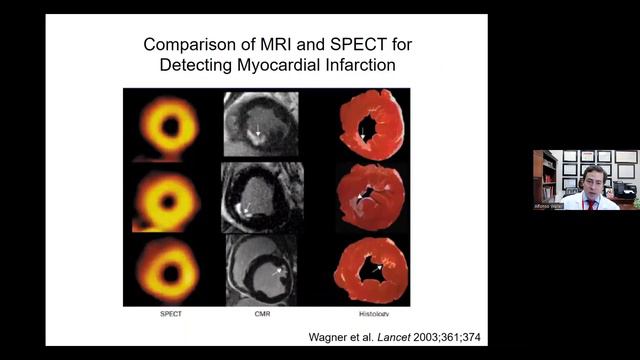 Building the Paradigms: Cardiac MRI for Cardiomyopathy смотреть онлайн
