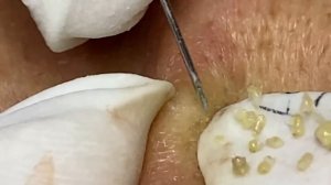 Enjoy Every Day With The Best Video Loan Nguyen Spa Official  2637