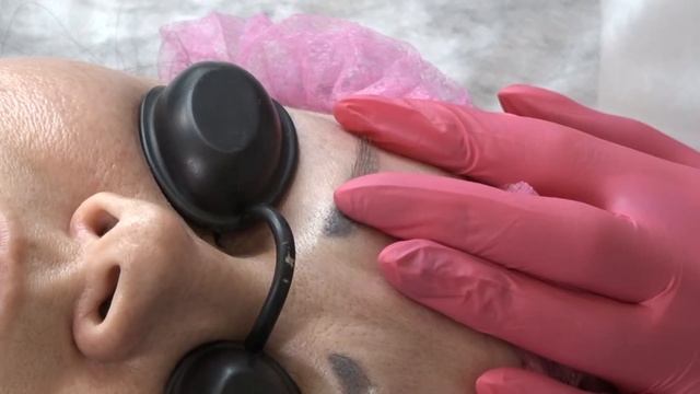 Удаление перманентного макияжа бровей лазером "Марина" смотреть онлайн