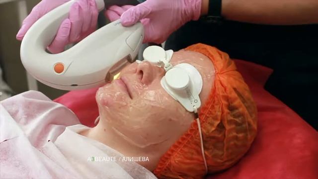 Фотоомоложение лица на аппарате М22 смотреть онлайн