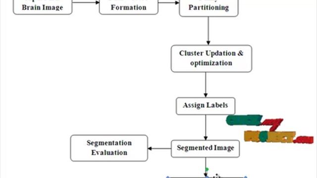 Final Year Projects | MRI BRAIN IMAGE SEGMENTATION USING MODIFIED FUZZY CMEANS CLUS смотреть онлайн