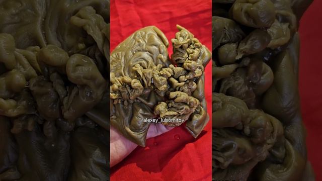 СНИМАЮ ПОРЧУ С РЕБЕНКА смотреть онлайн