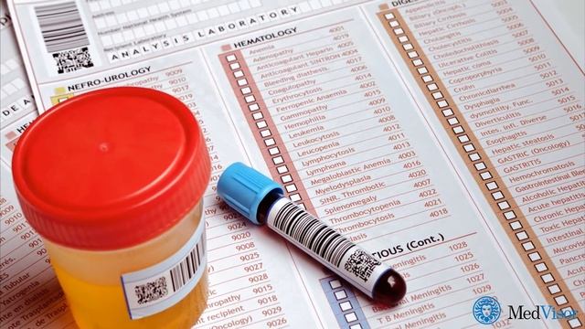 Что значит общий анализ мочи и когда его назначают смотреть онлайн