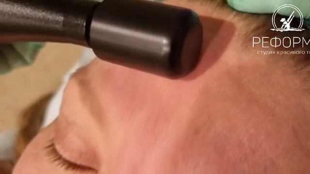 БМС лица по Назарову В.Т.