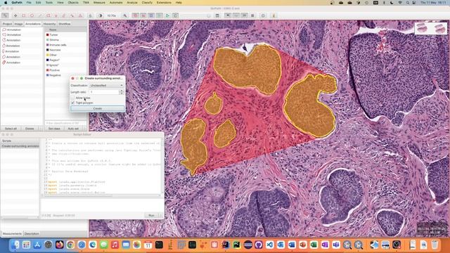 QuPath script - Create surrounding annotation смотреть онлайн