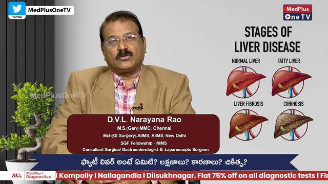 Stages of Liver Disease | Fatty Liver Awareness | Dr.DVL Narayana Rao @MedPlusONETV смотреть онлайн