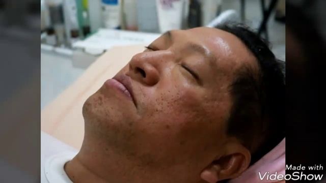 tutorial use B-TOX PEEL смотреть онлайн