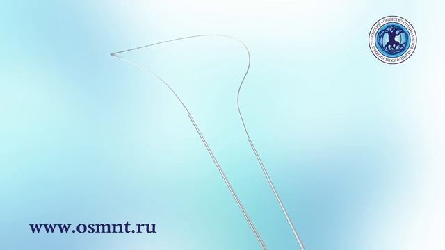 нитевой лифтинг область углов рта схема установки нитей конфигурации "С" ОСМНТ нитевой лифтинг смотреть онлайн