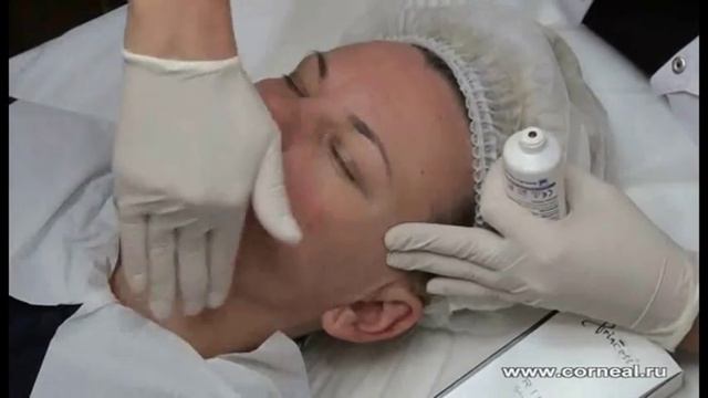 Пилинг для чувствительной кожи Jessner смотреть онлайн