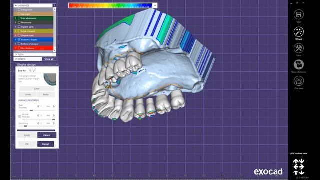 Exocad Pekkton Framework Design course смотреть онлайн
