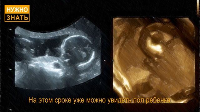 17 неделя беременности. Развитие плода. Как себя чувствует беременная. Как выглядит ребенок смотреть онлайн