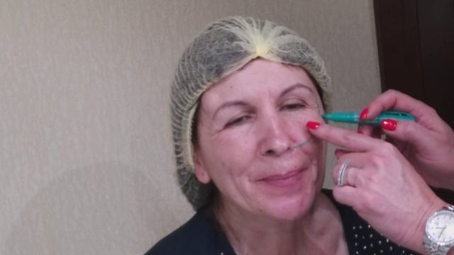 Нити. Исправляем ассиметрию(фрагмент).Разметка. смотреть онлайн