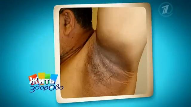 Как выглядит рак. Приметы врага смотреть онлайн