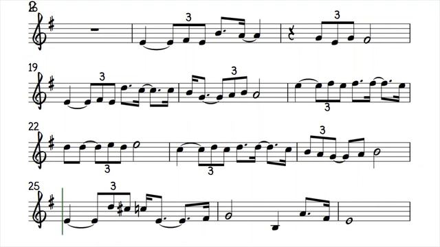 Greenfields Tenor Soprano Trumpet Clarinet Sheet Music Backing Track Play Along Partitura смотреть онлайн