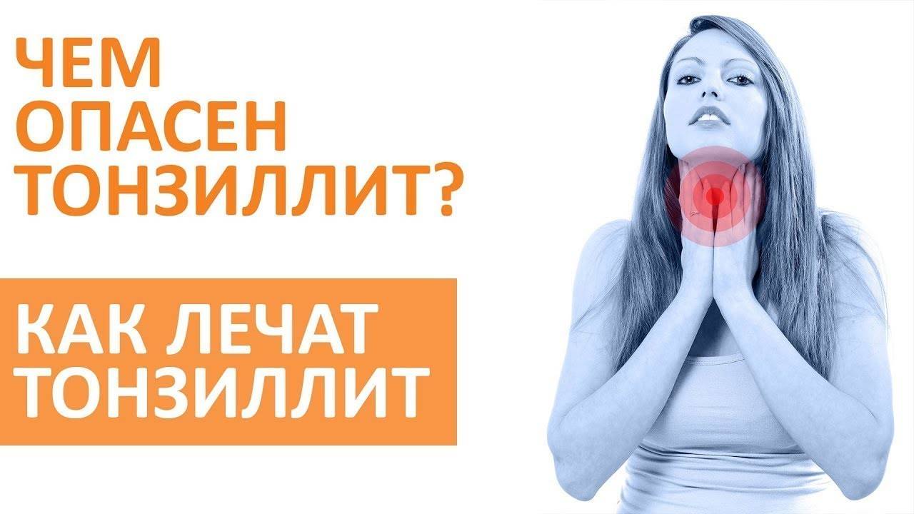 Лечение хронического тонзиллита смотреть онлайн