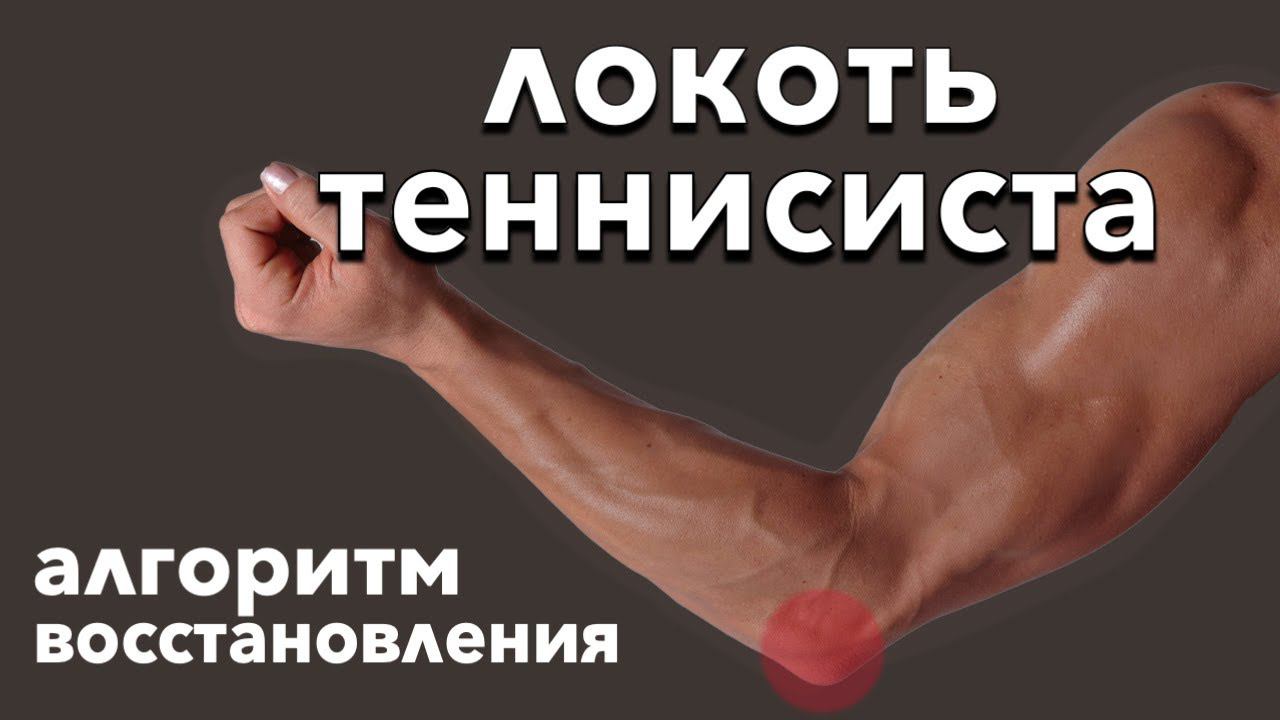 Боль в локте. Латеральный эпикондилит. Упражнения при локте теннисиста смотреть онлайн