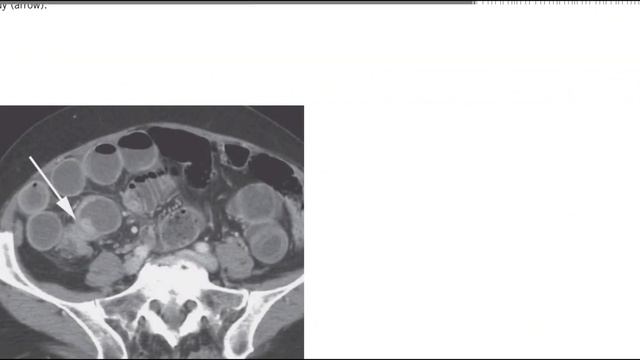GIT MC GRAW HILL RADIOLOGY BOOKS FRCR(4) смотреть онлайн