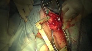 TPLO у собак при разрыве передней крестовидной связки