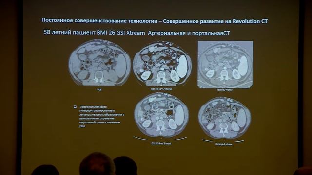 Alain Luciani — Spectral CT for Oncological Imaging смотреть онлайн