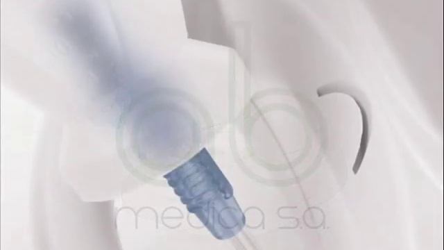 Happyneb II. Aerosol gama profesional 3a смотреть онлайн