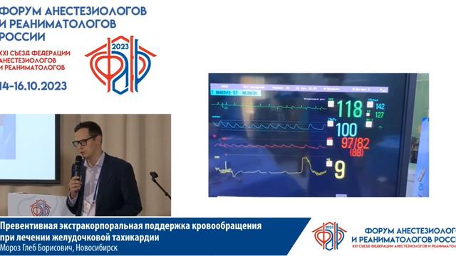 ЭКМО при желудочковой тахикардии Мороз Г.Б. смотреть онлайн