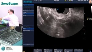 Мастер-класс на аппарате SonoScape S8Exp. Лектор: Буланов М.Н.