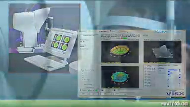 CustomVue LASIK | Tylock-George Eye Care | Greater Dallas, TX смотреть онлайн