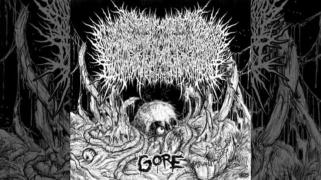 Pneumonoultramicroscopicsilicovolcanoconiosis