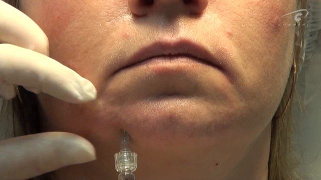 Когда клиент не хочет видимой коррекции губ смотреть онлайн