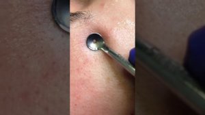 Чистка лица