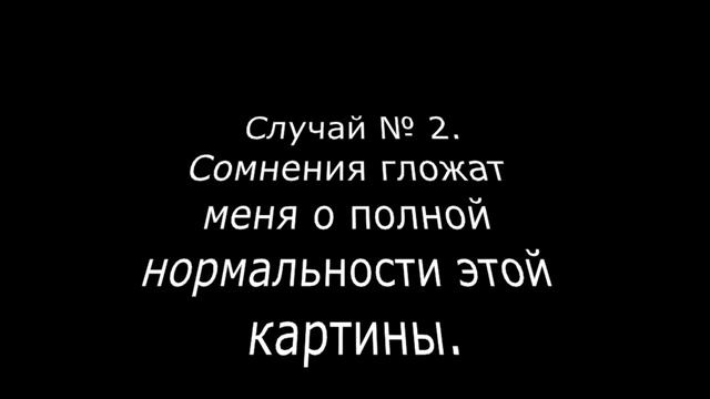 2 случая ЭХОКГ плода смотреть онлайн