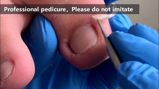 Pedicure Tutorial ：Excellent Pedicure Technique【Xue Yidao】