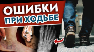 5 ошибок походки УБИВАЮТ организм! Срочно учимся правильно ХОДИТЬ!