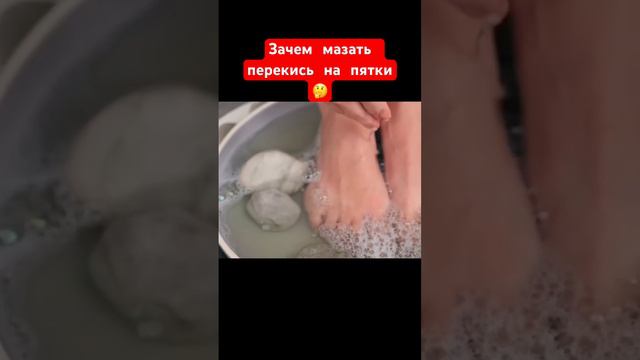 Зачем мазать перекись на пятки? Часть 2 смотреть онлайн