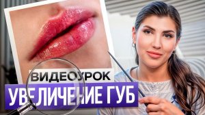 Это нужно знать КАЖДОМУ ВРАЧУ-КОСМЕТОЛОГУ! / Как сделать ПАРИЖСКИЕ ГУБЫ? ГЛАВНЫЙ СЕКРЕТ ТЕХНИКИ!