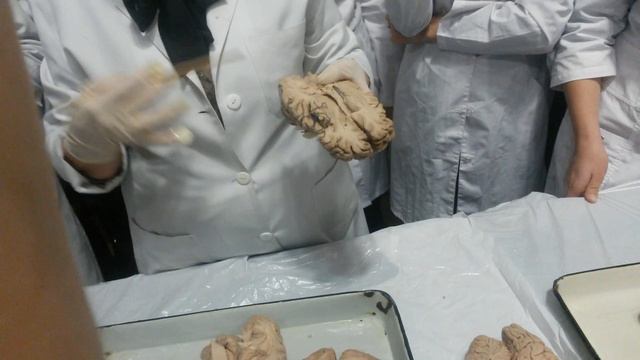 Анатомия ЦНС