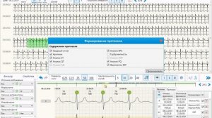 Формирование протокола холтеровского мониторирования в программе Поли-Спектр-СМ.NET