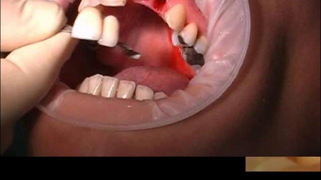 Мериленд мост