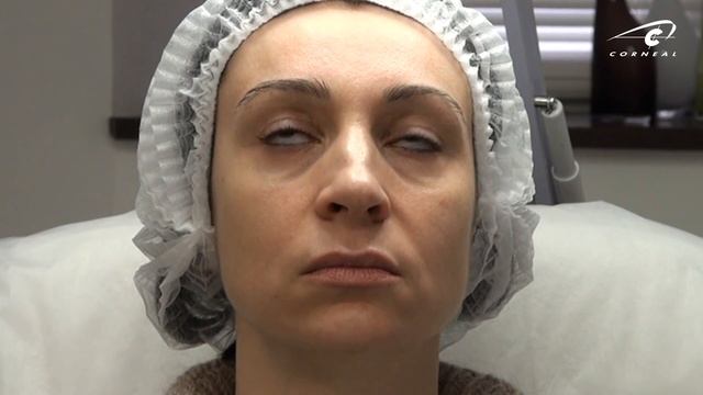 Контурная пластика губ. Определяем тактику: уменьшение или увеличение губ. смотреть онлайн