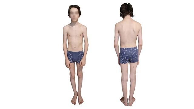 Визуальная диагностика осанки. смотреть онлайн