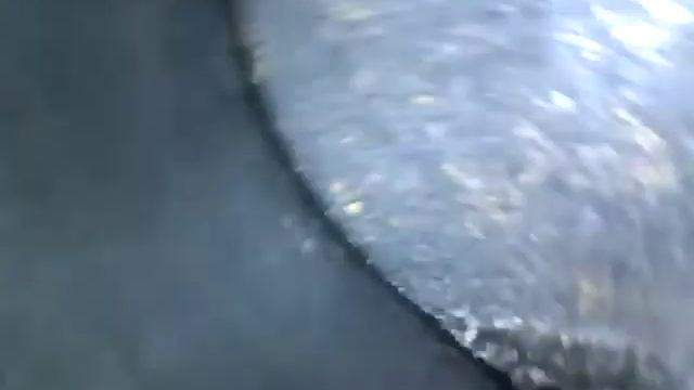 Эндоскопия ДВС. смотреть онлайн