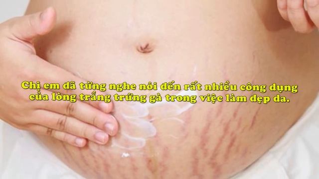 Rạn da khi mang bầu, cách ngừa và chữa rạn da khi mang bầu смотреть онлайн